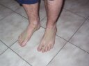 Davidkove spinave nohy 1.jpg
